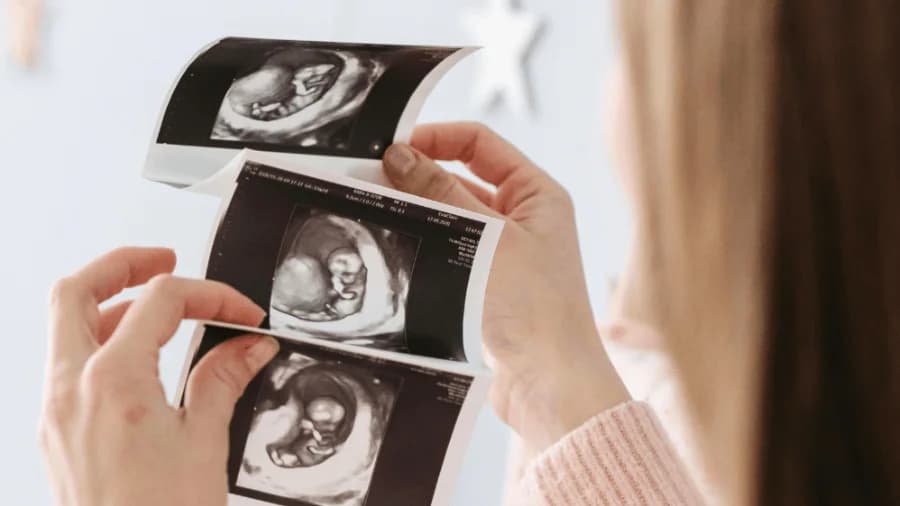 Pregnancy Genetic Testing Options and Purpose: What Expecting Parents Should Know