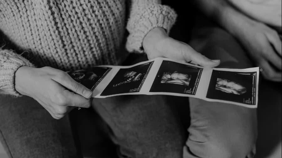 What a rare prenatal diagnosis taught me as a mother - and medical translator